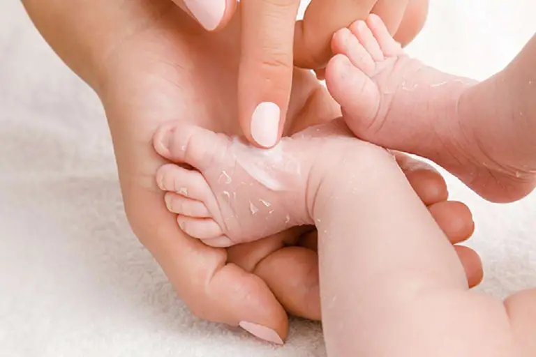 How to Treat Newborn Dry Skin