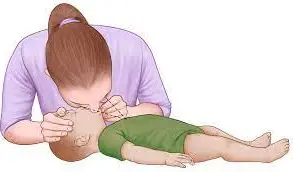 How to Give Rescue Breaths For Infants